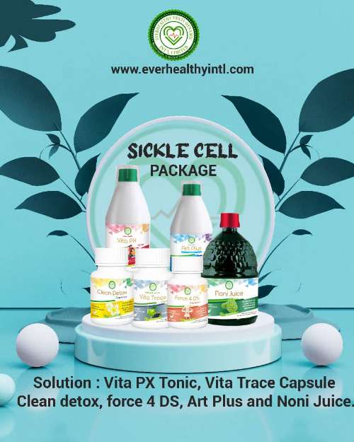 Treat sickle cells naturally with EMD