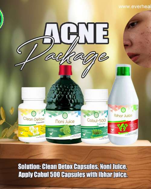 Treat and overcome acnes organically 