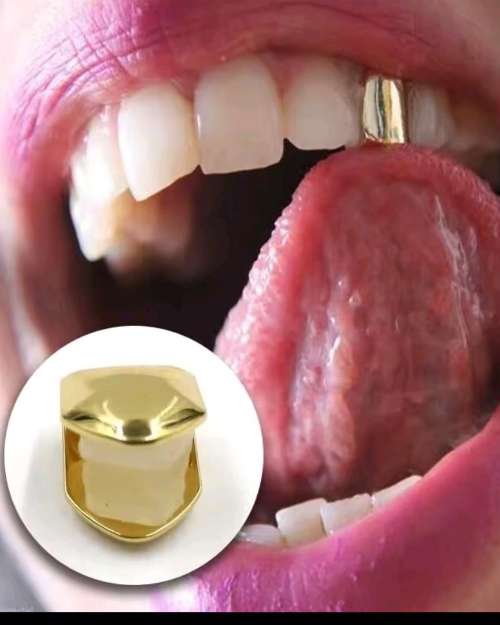 Gold Tooth Gem
