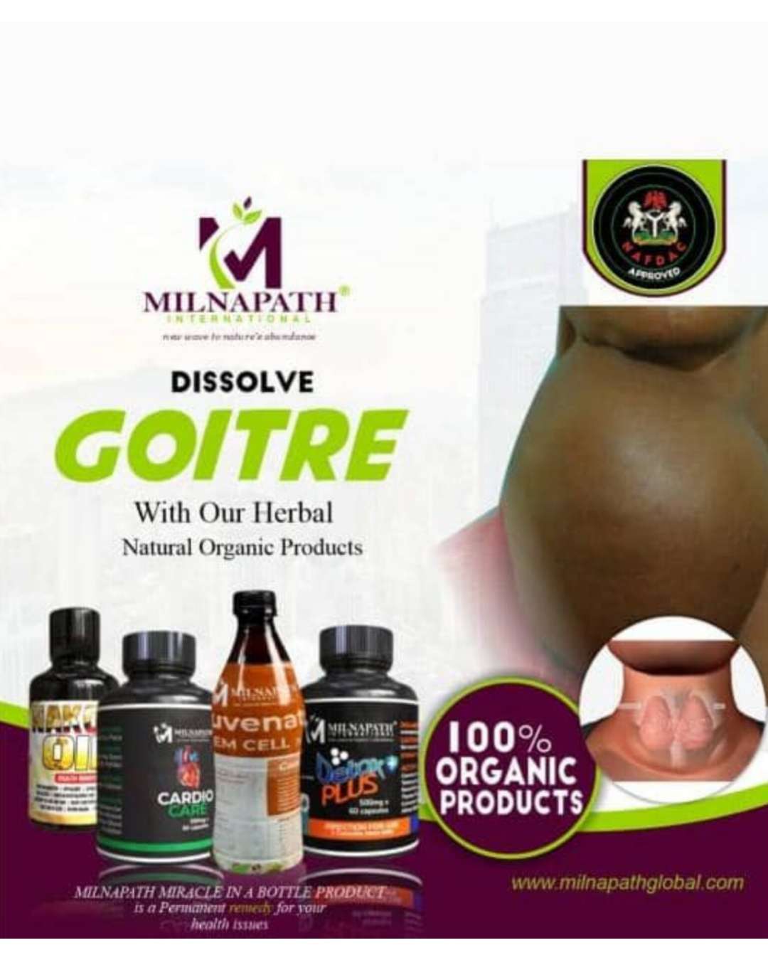 MILNAPATH GOITRE TREATMENT COMBO