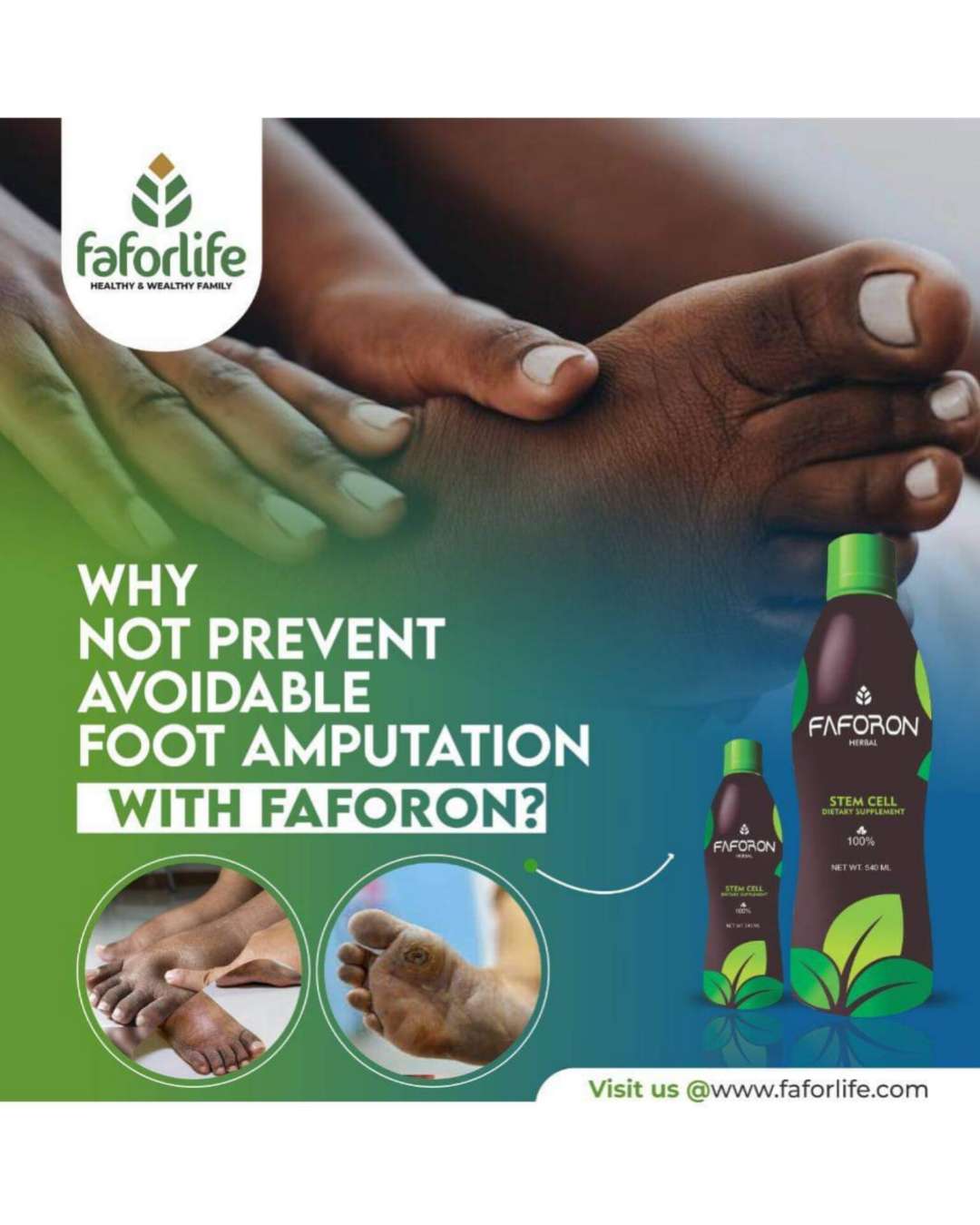 PREVENT FOOT AMPUTATION WITH FAFORON