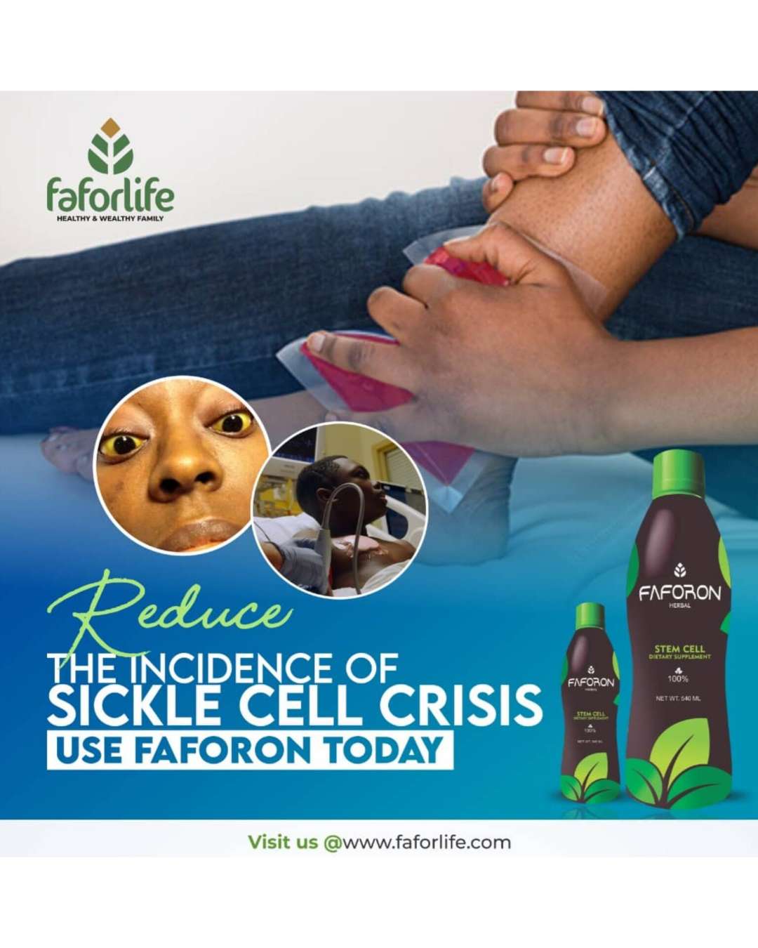 TREAT SICKLE CELL DISEASES AND CRISIS
