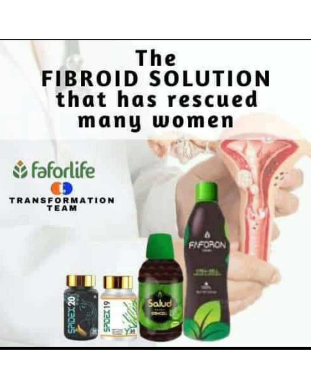 FIBROID SOLUTION WITH SPIDEX20, SALUD