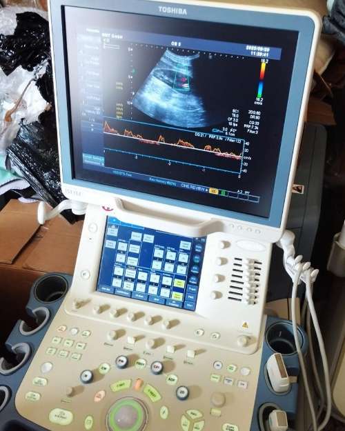 Toshiba Xario XG Ultrasound Machine 